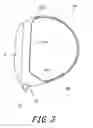 Fig. 04 - Golf club head