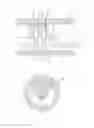 Fig. 02 - Mixed jet descaling device axially and eccentrically arranged for inner wall of pipe