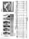 Fig. 06 - High toughness metallic glass-based composites for additive manufacturing