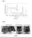 Fig. 13 - High toughness metallic glass-based composites for additive manufacturing