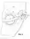 Fig. 06 - HVAC door with dentil features
