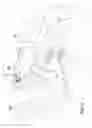 Fig. 05 - Carbon monoxide alarm assembly
