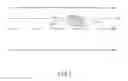 Fig. 04 - Steering assist device