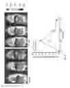 Fig. 22 - Optogenetic system based on bacterial phytochrome controllable with near infra-red light