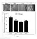 Fig. 11 - Antibody To Be Cross-Linked To Human SEMA3A And Use Thereof