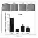 Fig. 13 - Antibody To Be Cross-Linked To Human SEMA3A And Use Thereof