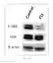 Fig. 25 - Antibody To Be Cross-Linked To Human SEMA3A And Use Thereof