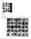 Fig. 10 - Chimeric proteins for targeting dsRNA