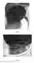 Fig. 02 - Anti-icing additive composition for bituminous conglomerates