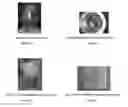 Fig. 03 - COMPOSITIONS AND METHODS FOR CLEANING A WELLBORE