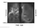 Fig. 32 - DIFFERENTIATION OF CORTICAL NEURONS FROM HUMAN PLURIPOTENT STEM CELLS