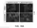 Fig. 44 - DIFFERENTIATION OF CORTICAL NEURONS FROM HUMAN PLURIPOTENT STEM CELLS