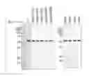 Fig. 01 - DNA polymerase variant