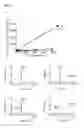 Fig. 04 - Engineered enzyme for enzyme replacement therapy
