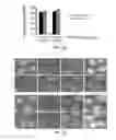 Fig. 03 - Methods of reducing expression of X-inactivation escapee genes and autosomal genes