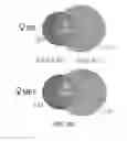 Fig. 15 - Methods of reducing expression of X-inactivation escapee genes and autosomal genes