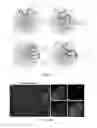 Fig. 29 - Methods of reducing expression of X-inactivation escapee genes and autosomal genes