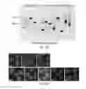 Fig. 30 - Methods of reducing expression of X-inactivation escapee genes and autosomal genes