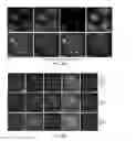 Fig. 31 - Methods of reducing expression of X-inactivation escapee genes and autosomal genes