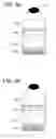 Fig. 05 - Method of producing electrically active bacteria reduced graphene oxide and electrically active bacteria reduced graphene oxide