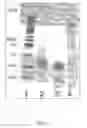 Fig. 03 - INACTIVATION OF PROTEASES
