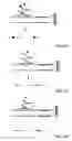Fig. 72 - Method for identification and enumeration of nucleic acid sequences, expression, splice variant, translocation, copy, or DNA methylation changes using combined nuclease, ligase, polymerase, terminal transferase, and sequencing reactions