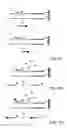 Fig. 75 - Method for identification and enumeration of nucleic acid sequences, expression, splice variant, translocation, copy, or DNA methylation changes using combined nuclease, ligase, polymerase, terminal transferase, and sequencing reactions