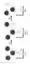 Fig. 17 - Ultra-sensitive multi-target lateral flow molecular assay with field-induced precipitation