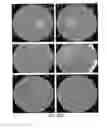 Fig. 09 - Panel-based Genetic Diagnostic Testing for Inherited Eye Diseases