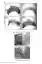 Fig. 04 - METHODS OF DIAGNOSING AND TREATING BREAST CANCER