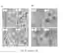 Fig. 05 - METHODS OF DIAGNOSING AND TREATING BREAST CANCER