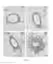 Fig. 09 - METHODS OF DIAGNOSING AND TREATING BREAST CANCER