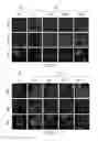 Fig. 11 - METHODS OF DIAGNOSING AND TREATING BREAST CANCER