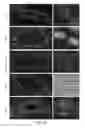 Fig. 13 - METHODS OF DIAGNOSING AND TREATING BREAST CANCER