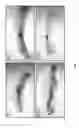 Fig. 24 - METHODS OF DIAGNOSING AND TREATING BREAST CANCER