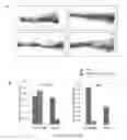 Fig. 27 - METHODS OF DIAGNOSING AND TREATING BREAST CANCER