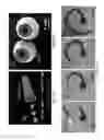 Fig. 07 - Membrane template synthesis of microtube engines