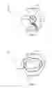 Fig. 04 - EXCREMENT MANAGEMENT DEVICE AND METHOD