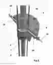 Fig. 09 - Containment systems for sealing a pass-through in a well, and methods therefore
