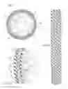 Fig. 04 - Sealing an undesirable formation zone in the wall of a wellbore