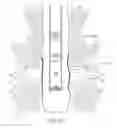 Fig. 18 - Sealing an undesirable formation zone in the wall of a wellbore