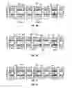 Fig. 04 - Apparatus, systems and methods for multi-stage stimulation