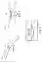 Fig. 04 - Belly band seals