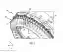 Fig. 06 - Systems for reducing deflection of a shroud that retains fan exit stators