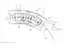 Fig. 01 - Plate link chain