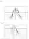 Fig. 12 - Strain wave gearing with full separation of two stresses