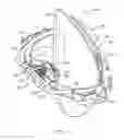 Fig. 02 - LED-based dental exam lamp