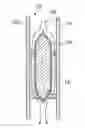 Fig. 01 - PRESSURE EQUALIZING ORIFICE FOR BAFFLES IN VANES