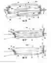 Fig. 07 - Gun guard