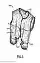 Fig. 03 - Impact marking garment